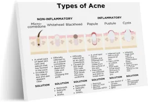 Acne Types Guide Different Types of Acne Dermatology Hospital Knowledge Poster (11) Canvas Print Wall Art Decoration Living Room Office Bedroom Aesthetic 32x24inch(80x60cm) Frame-style