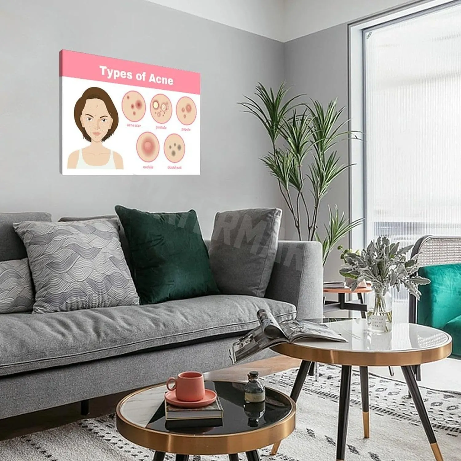 INSTR Beauty Salon Poster Acne Type Guide Art Wall Poster Wall Poster Art Canvas Printing Poster Office Bedroom Aesthetic Poster Frame-style 30x20inch(75x50cm)