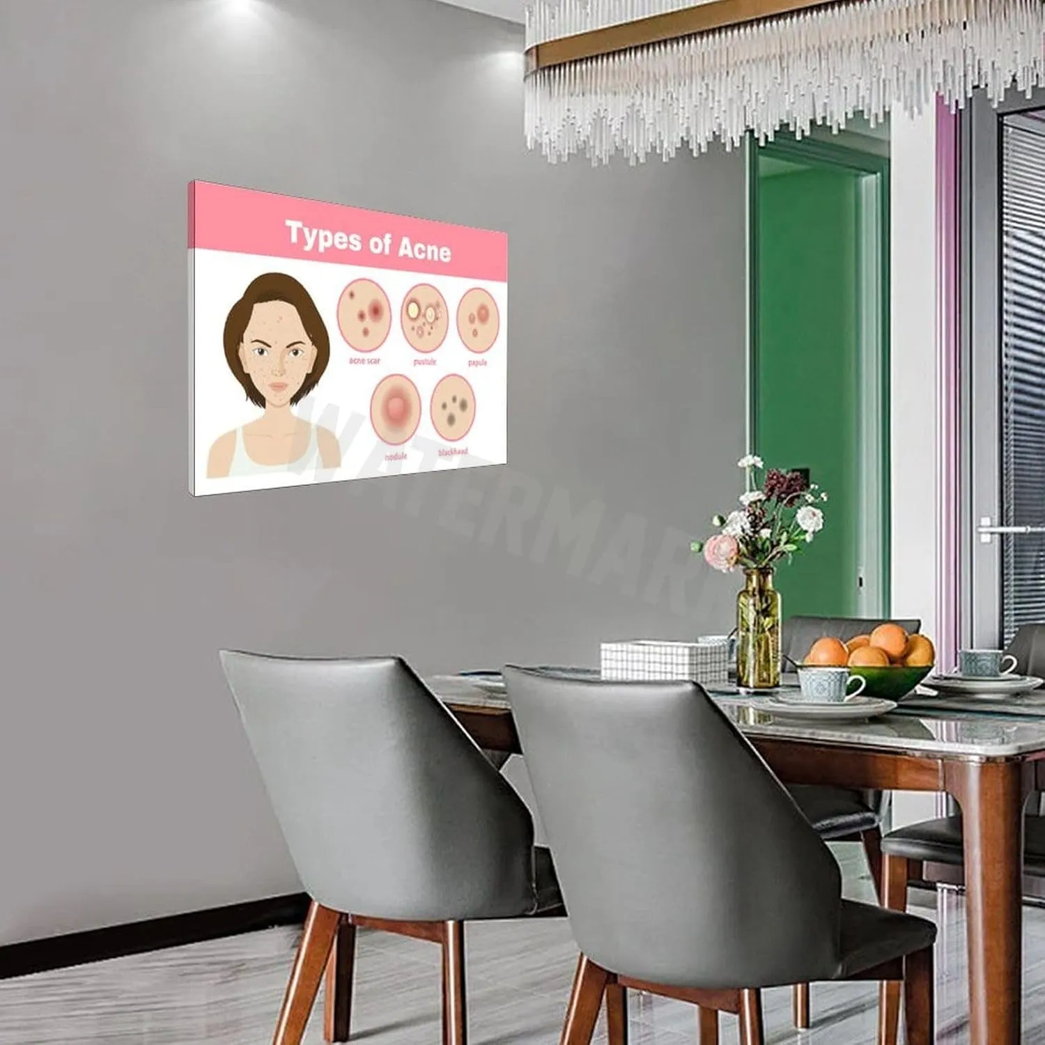 INSTR Beauty Salon Poster Acne Type Guide Art Wall Poster Wall Poster Art Canvas Printing Poster Office Bedroom Aesthetic Poster Frame-style 30x20inch(75x50cm)