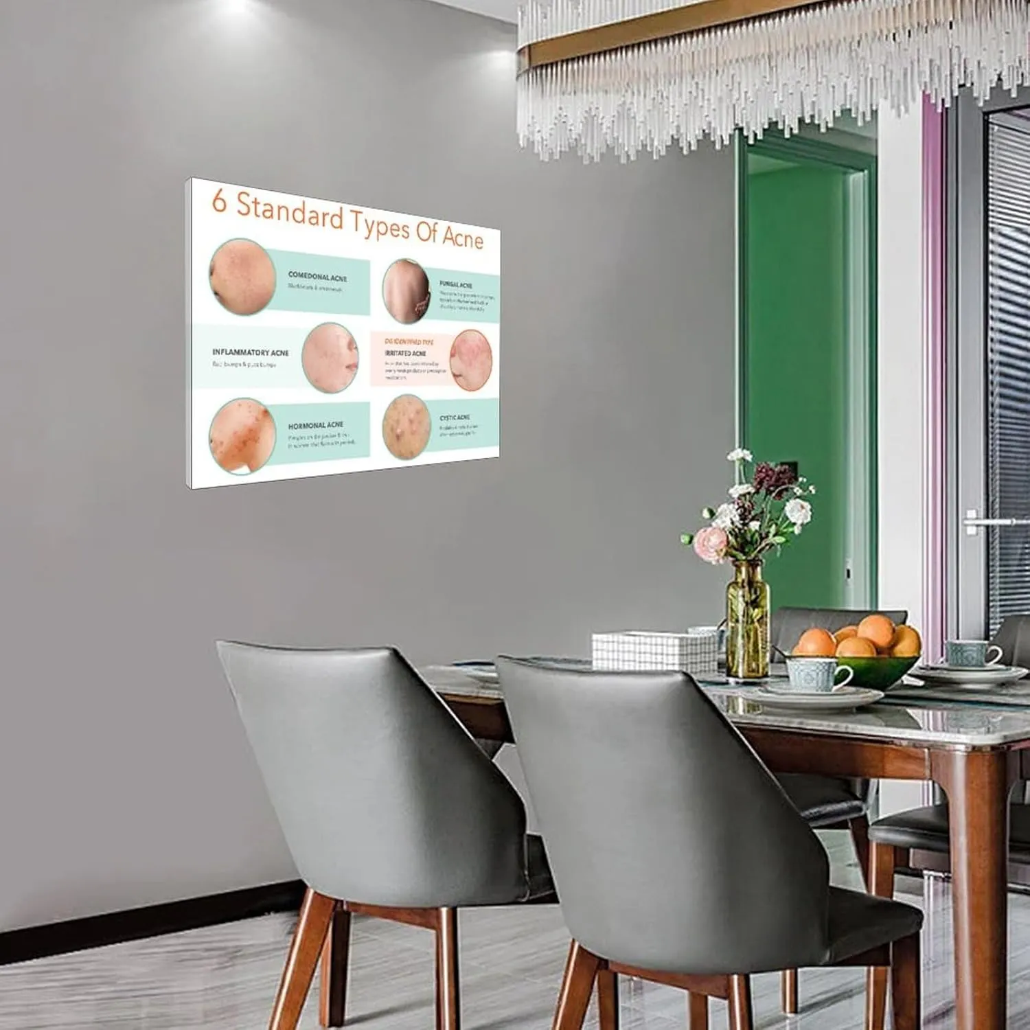 Types of Acne Poster Medical Beauty Poster (4) Wall Poster Art Canvas Printing Living Room Office Bedroom Aesthetic Poster 32x24inch(80x60cm) Frame-style