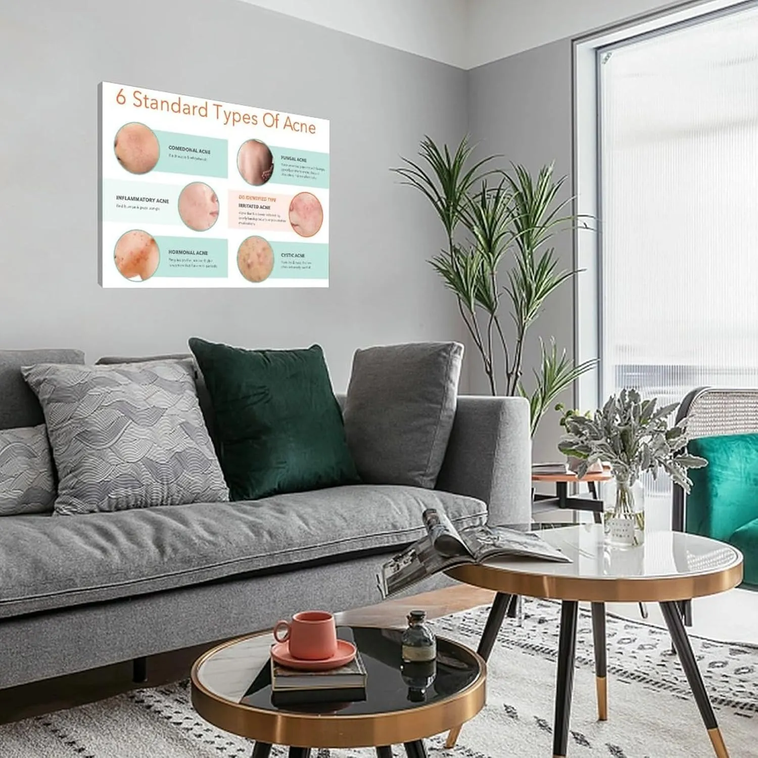 Types of Acne Poster Medical Beauty Poster (4) Wall Poster Art Canvas Printing Living Room Office Bedroom Aesthetic Poster 32x24inch(80x60cm) Frame-style